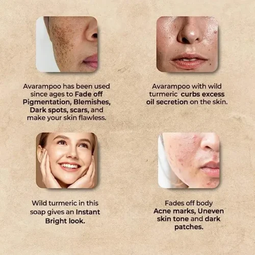 Benefits of Avarampoo soap removes pigmentiton