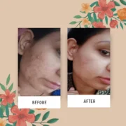 Green tea gel moringa facewash green tea pineapple haritah